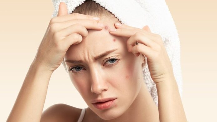 5-makanan-yang-jarang-disadari-bisa-bikin-jerawat-munculfoto-freepikcomwayhomestudio-1765274751824_169