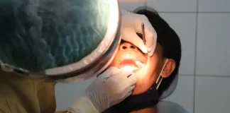 Akibat Jika Gigi Susu Anak Tidak Tanggal, Berikut Penjelasannya